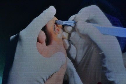 Live Surgery Sessions
